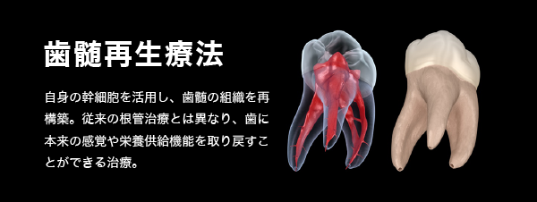 ②歯髄再生
